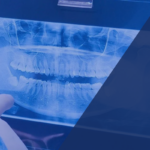 Moderne zahnärztliche Diagnostik mit digitalem Röntgen in Passau