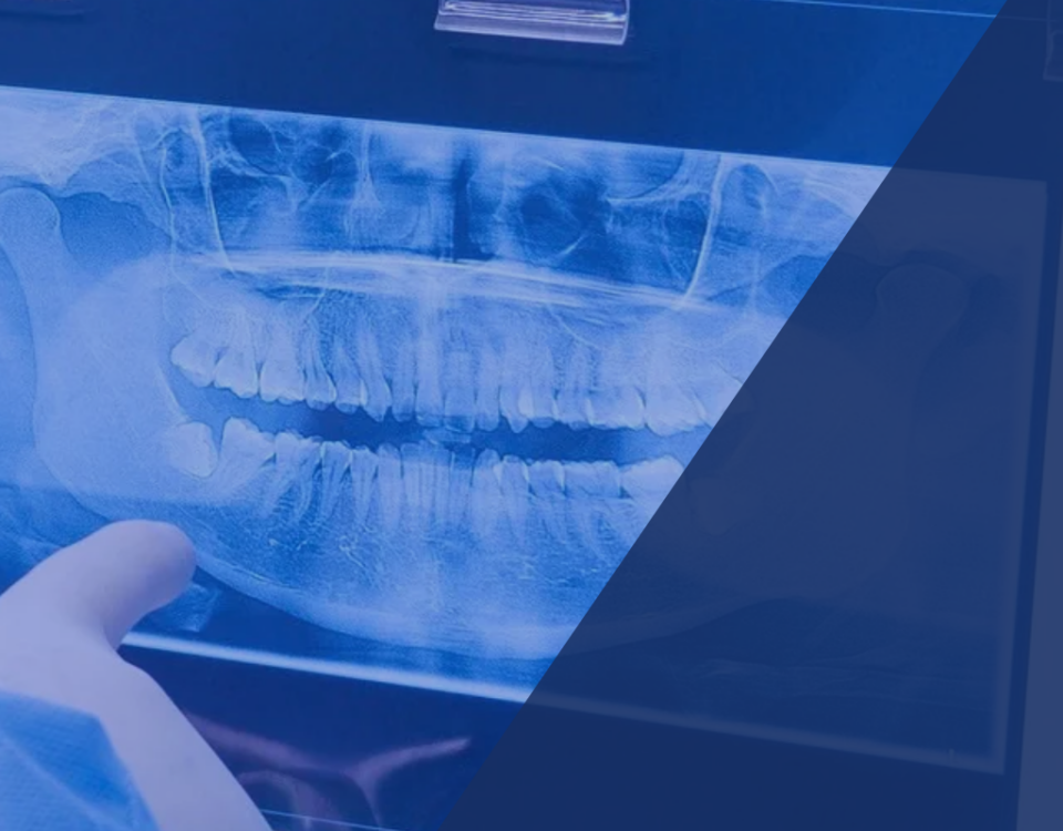 Moderne zahnärztliche Diagnostik mit digitalem Röntgen in Passau