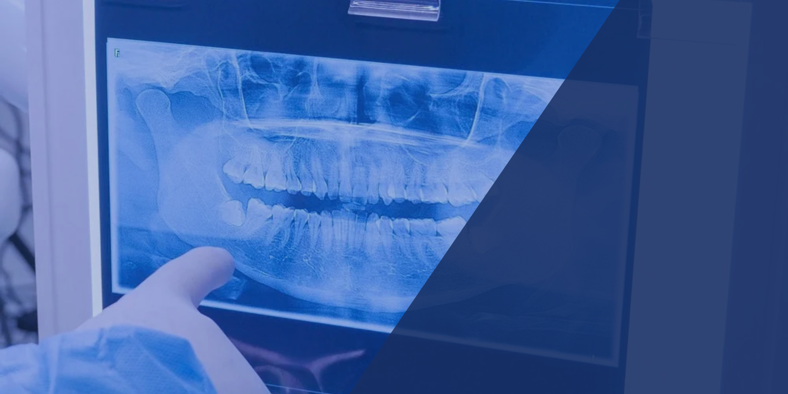Moderne zahnärztliche Diagnostik mit digitalem Röntgen in Passau